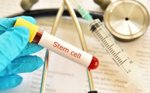 4 Ways Stem Cell Research is Improving